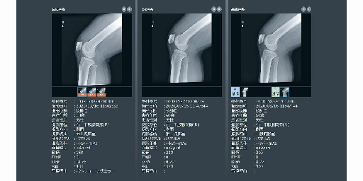 診療画像検査法 X線撮影法 コニカミノルタ、AIで整形領域のX線撮影をサポートするポジショニング