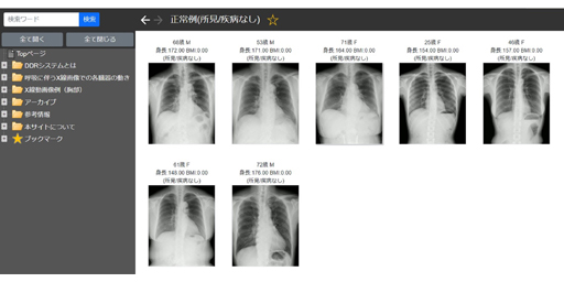 X線動画像のデジタル症例集「DDRAtlas Ver. 1.0」を公開～一般X線撮影