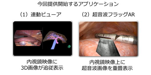 富士フイルム、手術室や検査室でのスムーズな画像参照を支援　術場画像追従・重畳システム「SYNAPSE VINCENT Eye」新発売　3Dシミュレーション画像や超音波画像を内視鏡映像に追従・重畳表示することが可能