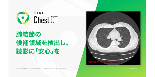 エルピクセル、胸部CT画像診断支援AI「EIRL Chest CT」、計測機能の拡充機能等を追加した新モデルを発売～多角的な定量評価の支援と視認性向上を目指す～