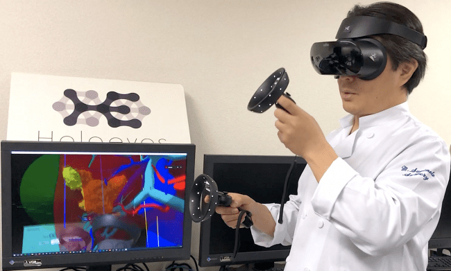 Holoeyes、医療用画像3D空間表示サービス「Holoeyes MD」販売開始