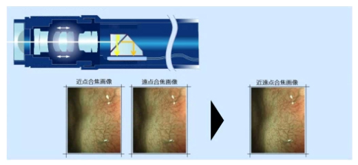 EDOF（被写界深度拡大技術）：Extended Depth of Field