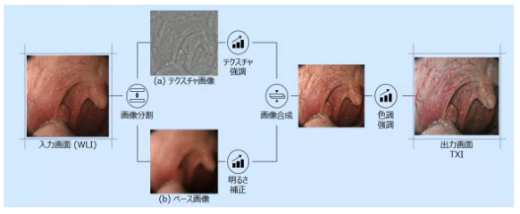 TXI（構造色彩強調機能）：Texture and Color Enhancement Imaging