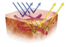 NBI（狭帯域光観察）：Narrow Band Imaging