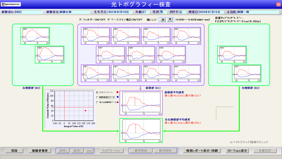光トポグラフィー検査報告書