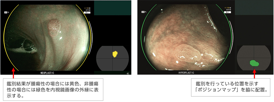図3：CAD EYE 疾患鑑別支援機能（＊本画像は、一部を加工したイメージ画像）