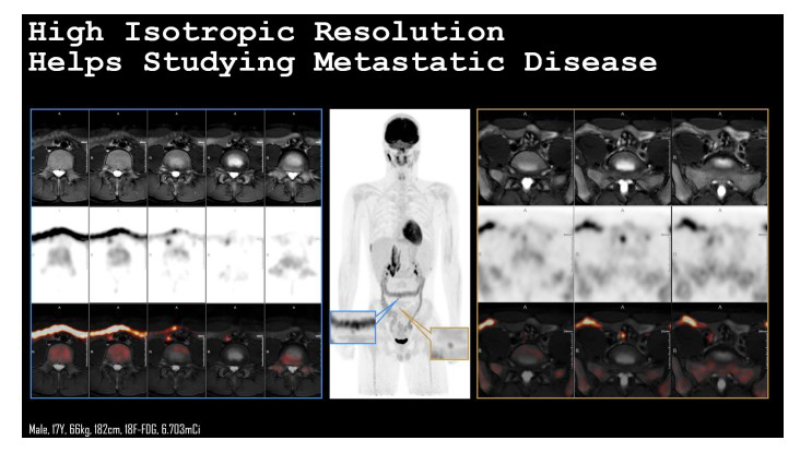 United Imaging Healthcare Japan、PET/MRI 装置を発売 | 映像情報Medical