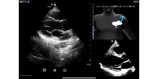 GEヘルスケア・ジャパン、超音波診断装置「Vscan」シリーズにAI機能を初搭載した「Vscan Air SL Ally」を販売開始～2つのAI機能で心エコー検査の質と精度をさらに向上～