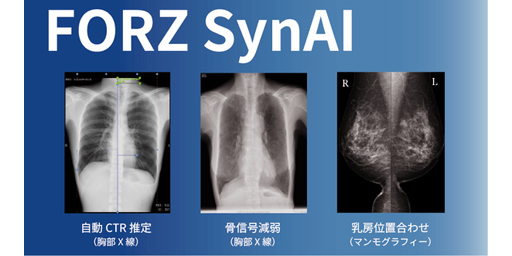 エクセル・クリエイツ【医療DX】医師の負担を軽減。AI画像解析プラットフォーム「FORZSynAI」リリース
